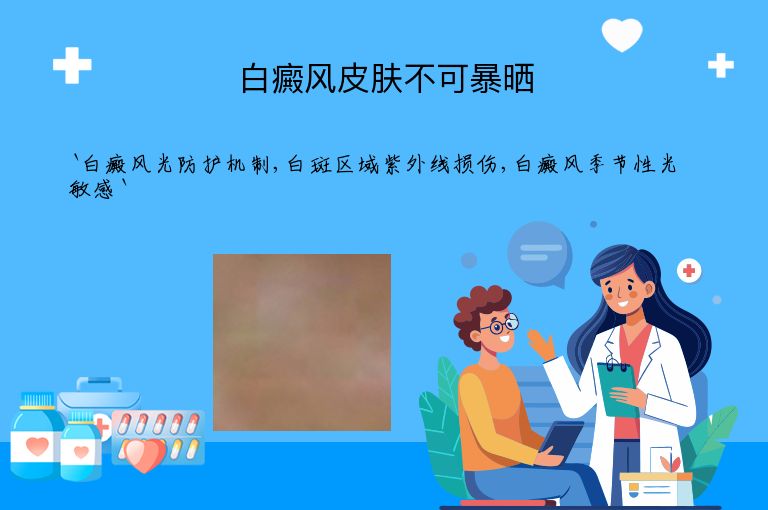 白癜风皮肤不可暴晒