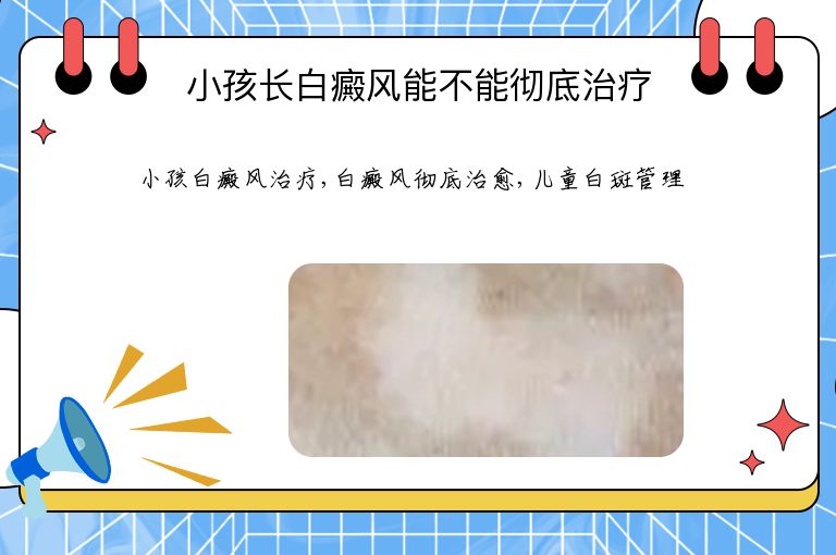 小孩长白癜风能不能彻底治疗”