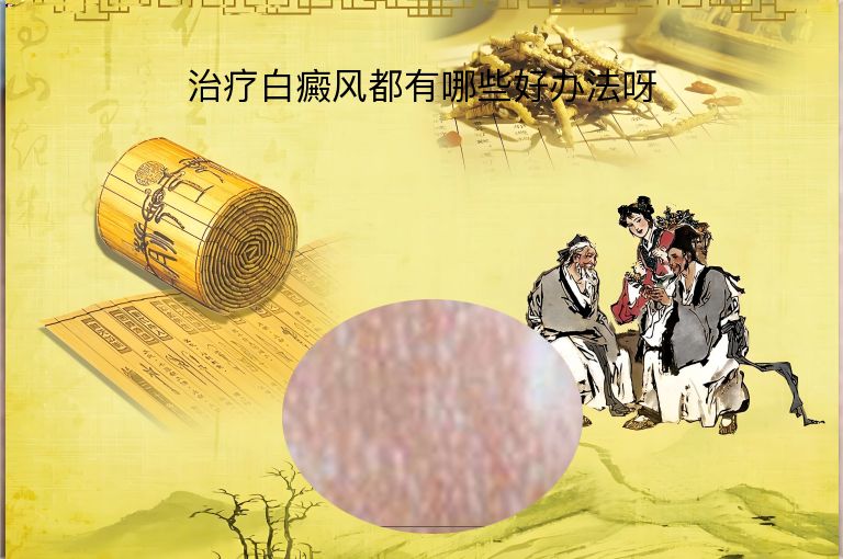 https://www.bdfsjzyy.com/d/file/p/545314ddb3490e1257c927c426849196.jpeg