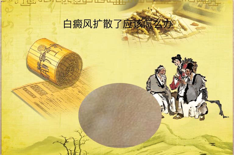 https://www.bdfsjzyy.com/d/file/p/bfeadd346d3840a737661bb5b0f83cd8.jpeg