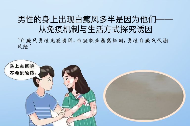 男性的身上出现白癜风多半是因为他们——从免疫机制与生活方式探究诱因