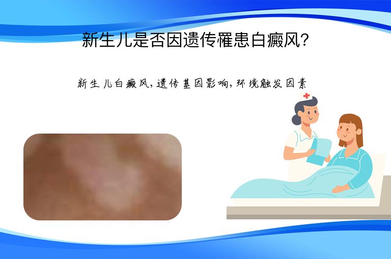 新生儿是否因遗传罹患白癜风？”