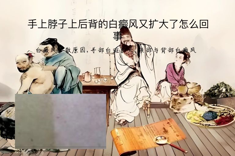 https://www.bdfsjzyy.com/d/file/p/2d5c0dfd5c8175e97533853dcf0c7864.jpeg
