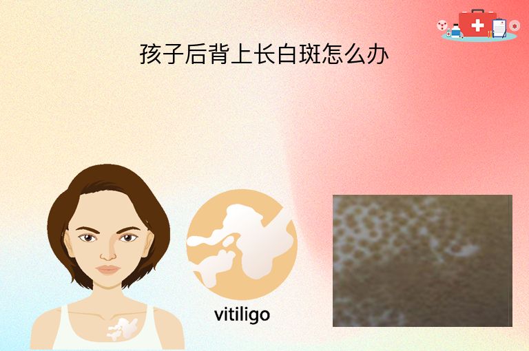 孩子后背上长白斑怎么办”