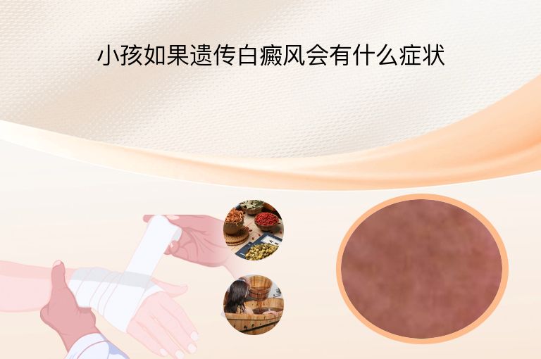 小孩如果遗传白癜风会有什么症状