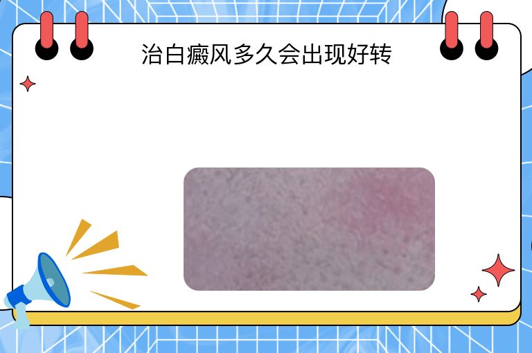 https://www.bdfsjzyy.com/d/file/p/c4e13c7dc11b3997d1746a50bbe2454a.jpeg