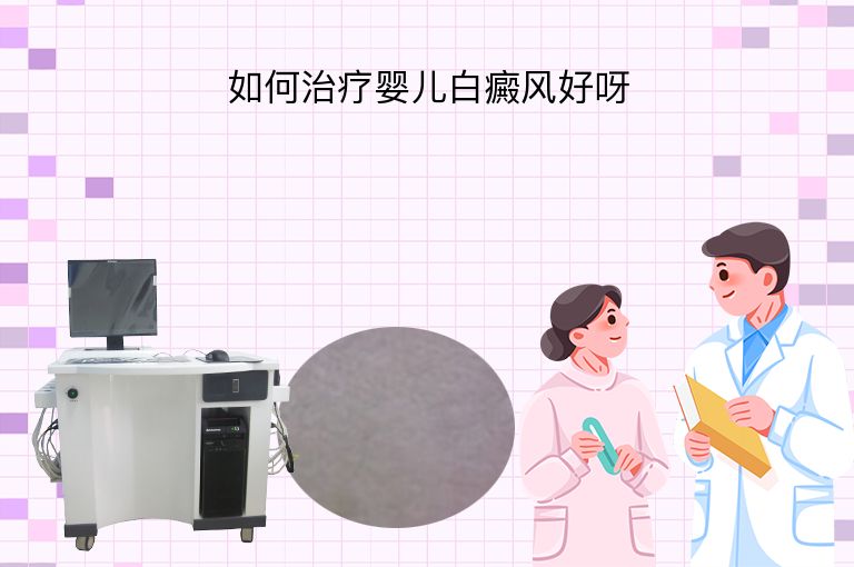 如何治疗婴儿白癜风好呀”