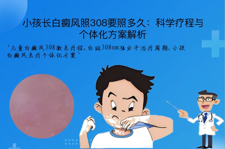 小孩长白癜风照308要照多久：科学疗程与个体化方案解析”