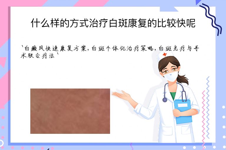 什么样的方式治疗白斑康复的比较快呢