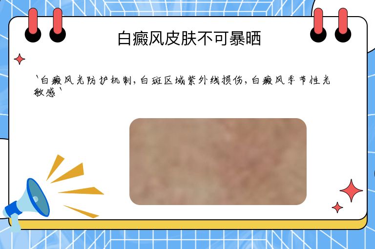 白癜风皮肤不可暴晒