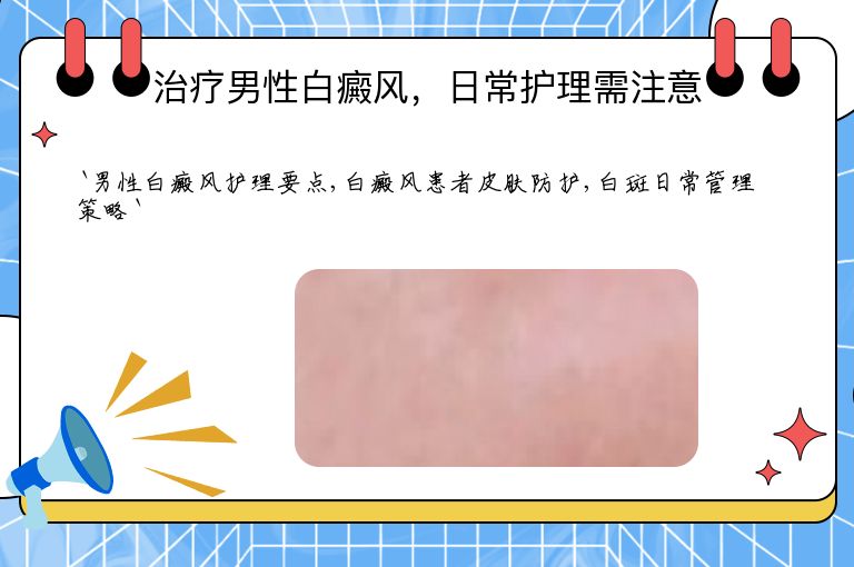 治疗男性白癜风，日常护理需注意