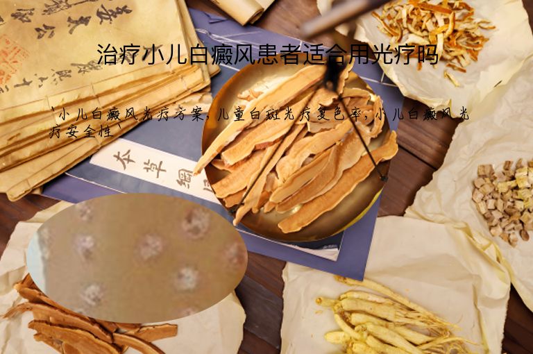 治疗小儿白癜风患者适合用光疗吗