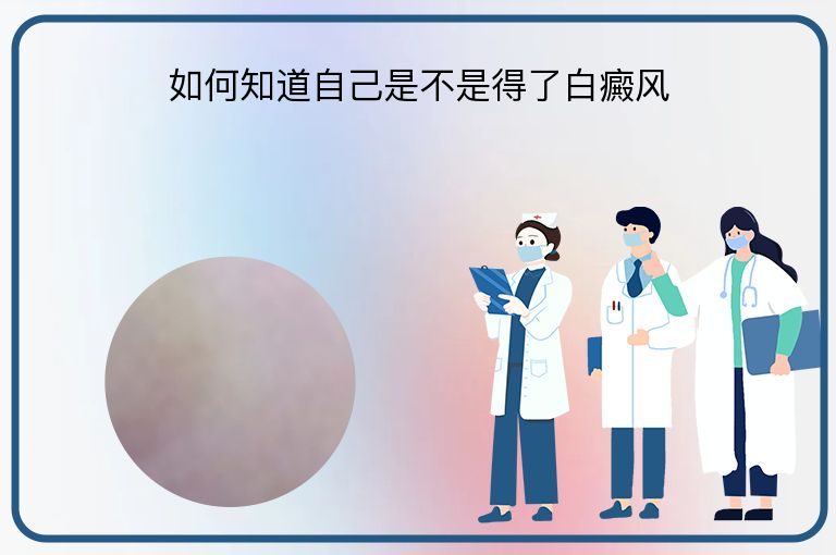 如何知道自己是不是得了白癜风