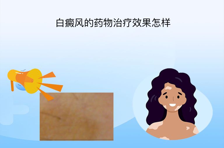 白癜风的药物治疗效果怎样”