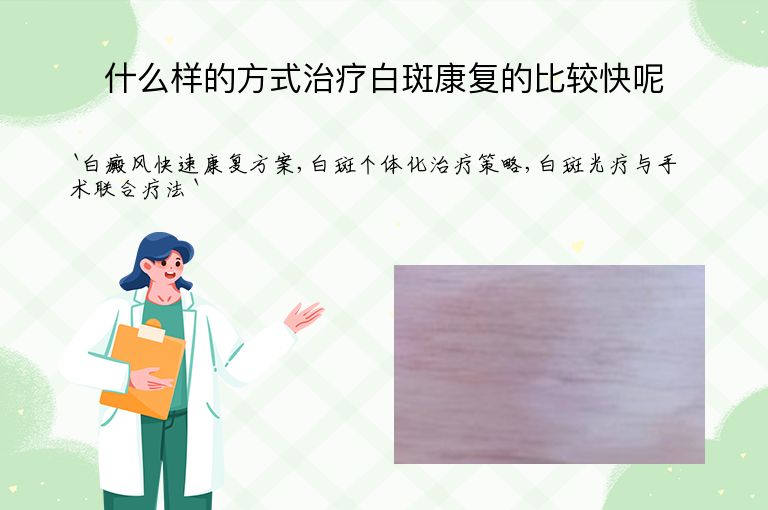 什么样的方式治疗白斑康复的比较快呢