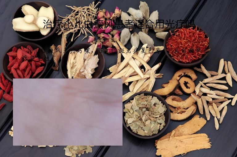 治疗小儿白癜风患者适合用光疗吗