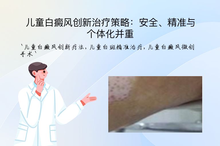 儿童白癜风创新治疗策略：安全、精准与个体化并重