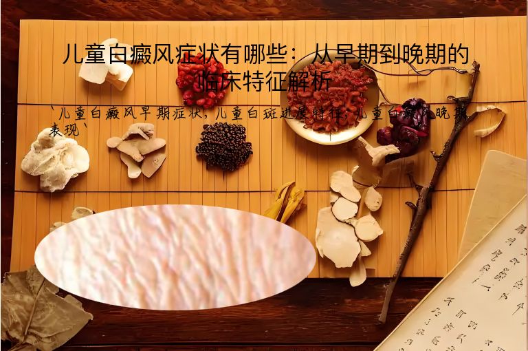 儿童白癜风症状有哪些:从早期到晚期的临床特征解析