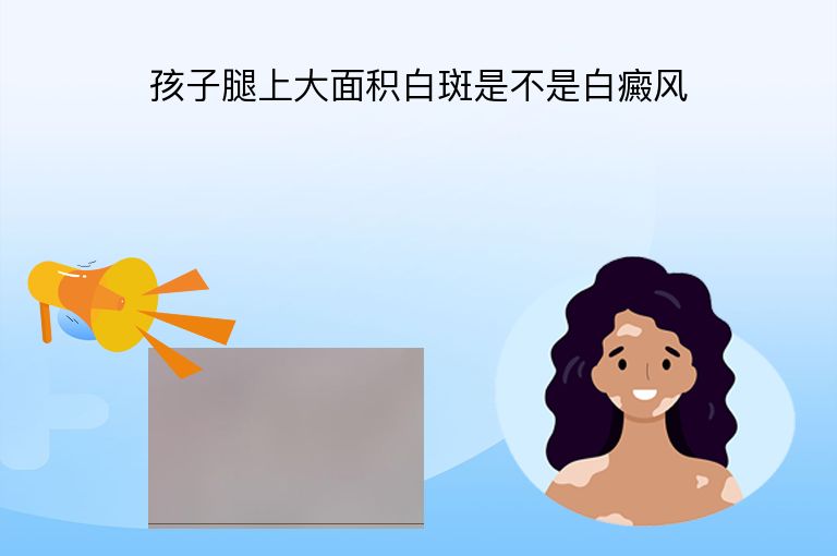 https://www.bdfsjzyy.com/d/file/p/b1364d8fa988baa066946e2483ae0f0b.jpeg
