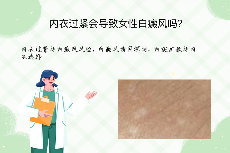 内衣过紧会导致女性白癜风吗?”