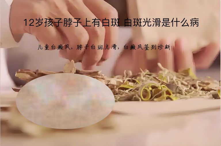 12岁孩子脖子上有白斑 白斑光滑是什么病”