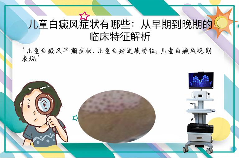 儿童白癜风症状有哪些:从早期到晚期的临床特征解析