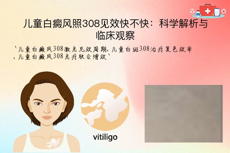 儿童白癜风照308见效快不快：科学解析与临床观察