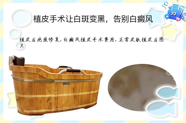 植皮手术让白斑变黑,告别白癜风”