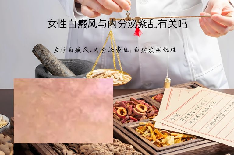 女性白癜风与内分泌紊乱有关吗”