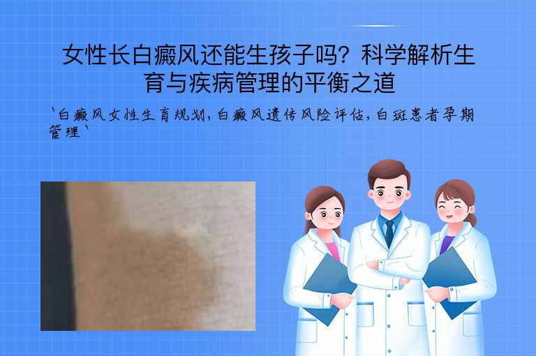 女性长白癜风还能生孩子吗?科学解析生育与疾病管理的平衡之道”