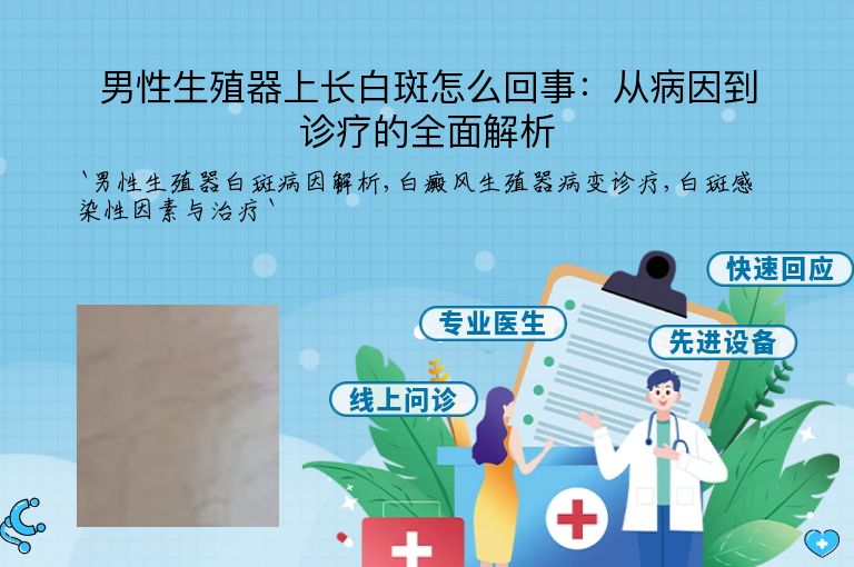 男性生殖器上长白斑怎么回事:从病因到诊疗的全面解析