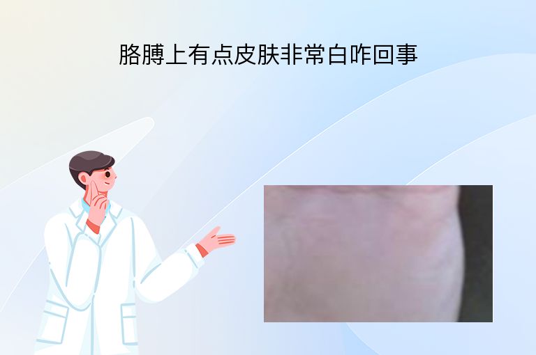 胳膊上有点皮肤非常白咋回事