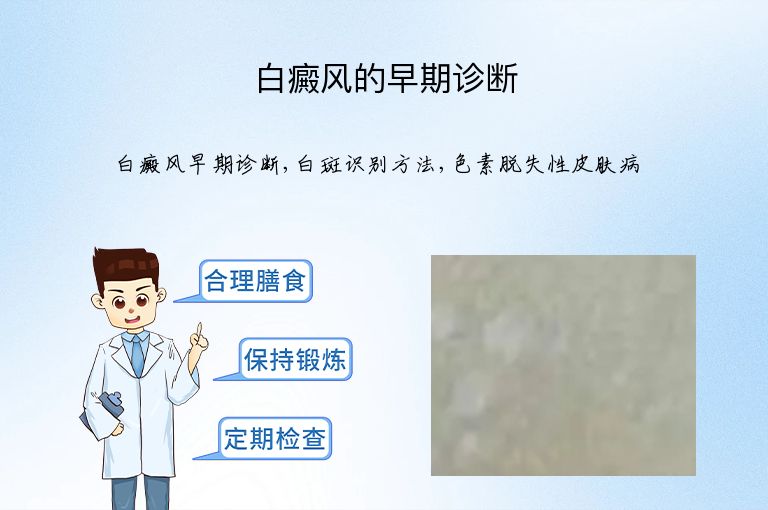 白癜风的早期诊断”