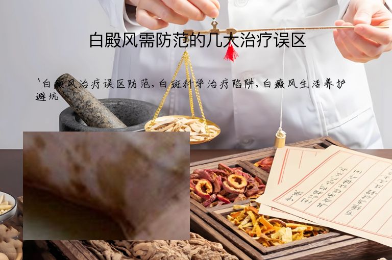 白殿风需防范的几大治疗误区”