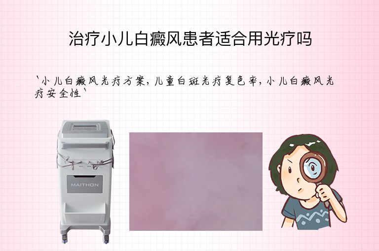 治疗小儿白癜风患者适合用光疗吗
