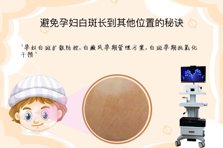 避免孕妇白斑长到其他位置的秘诀