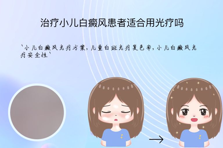 治疗小儿白癜风患者适合用光疗吗