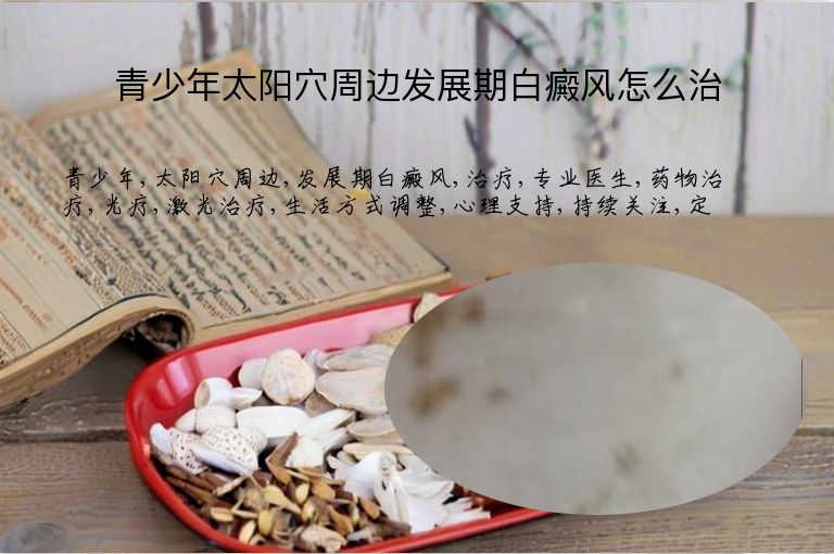 青少年太阳穴周边发展期白癜风怎么治”