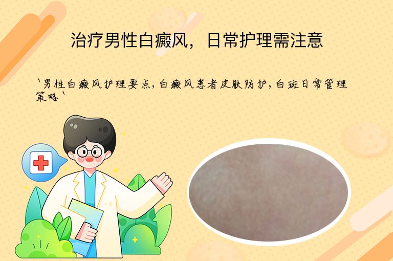 治疗男性白癜风,日常护理需注意