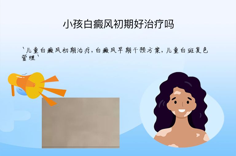 小孩白癜风初期好治疗吗