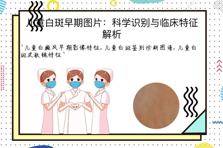 儿童白斑早期图片：科学识别与临床特征解析