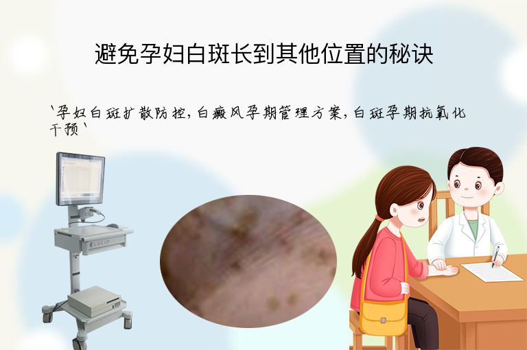 避免孕妇白斑长到其他位置的秘诀