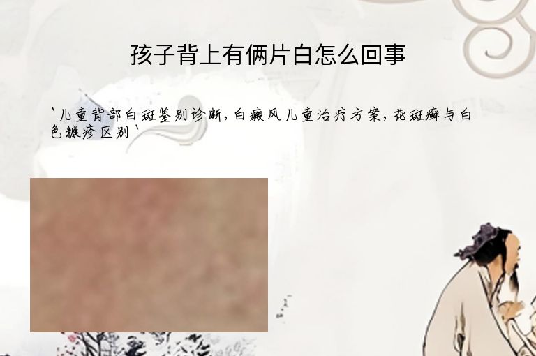 孩子背上有俩片白怎么回事