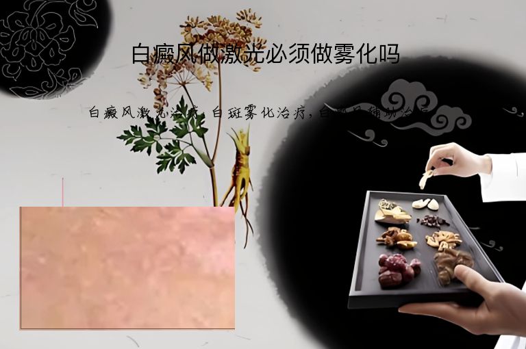 白癜风做激光必须做雾化吗”