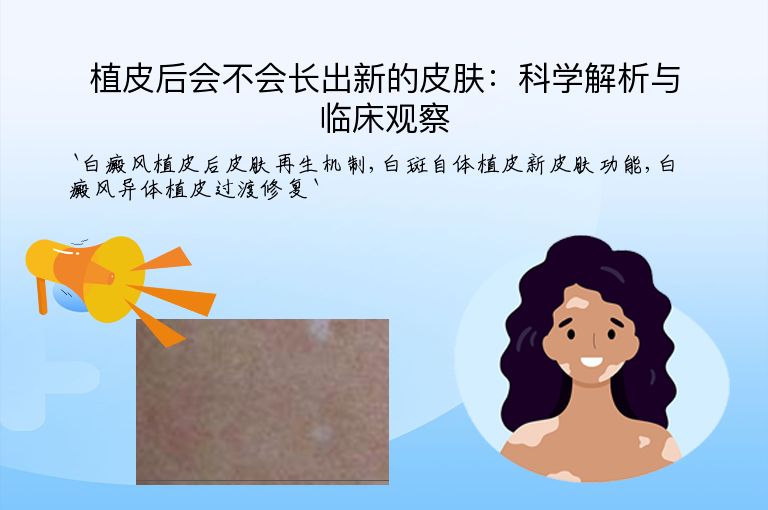植皮后会不会长出新的皮肤：科学解析与临床观察”