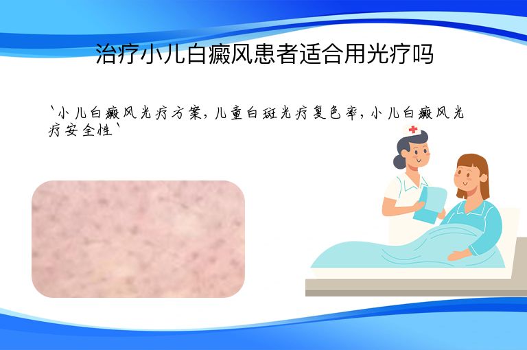 治疗小儿白癜风患者适合用光疗吗
