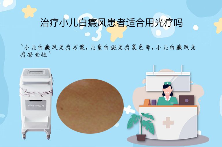 治疗小儿白癜风患者适合用光疗吗