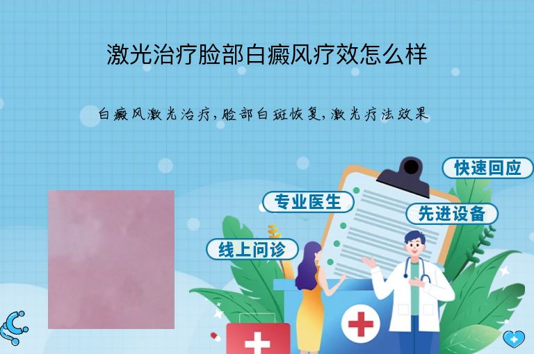 激光治疗脸部白癜风疗效怎么样”