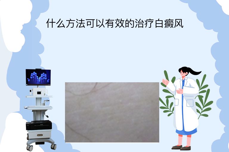 什么方法可以有效的治疗白癜风”