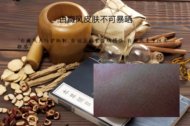 白癜风皮肤不可暴晒